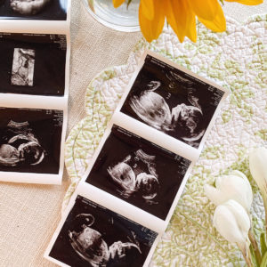 Katies Bliss Pregnancy Update